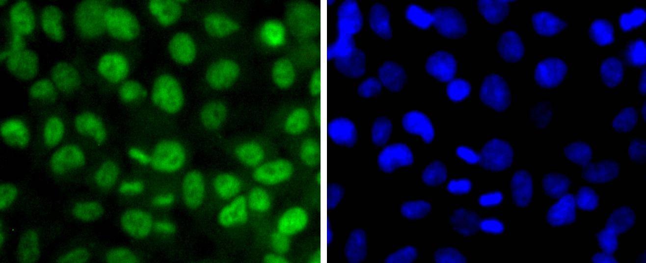 Anti-Phospho-SIRT1 (Thr530) Antibody (4S678)