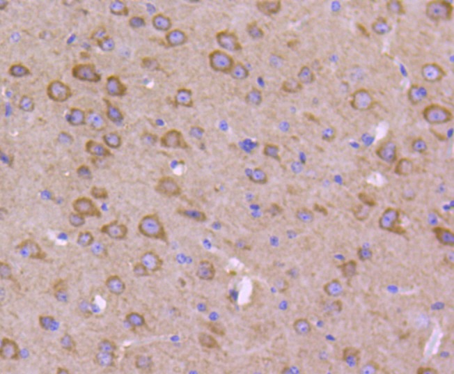 Anti-Phospho-GSK3A/B (Tyr216/279) Antibody (3N852)