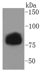 Anti-Phospho-Hormone sensitive lipase (Ser853) Antibody (4W954)
