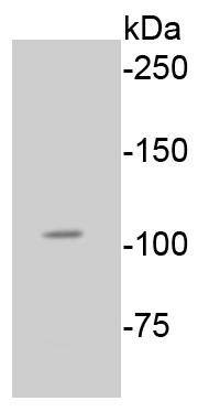 Anti-Phospho-RB1 (Ser807) Antibody (7O884)