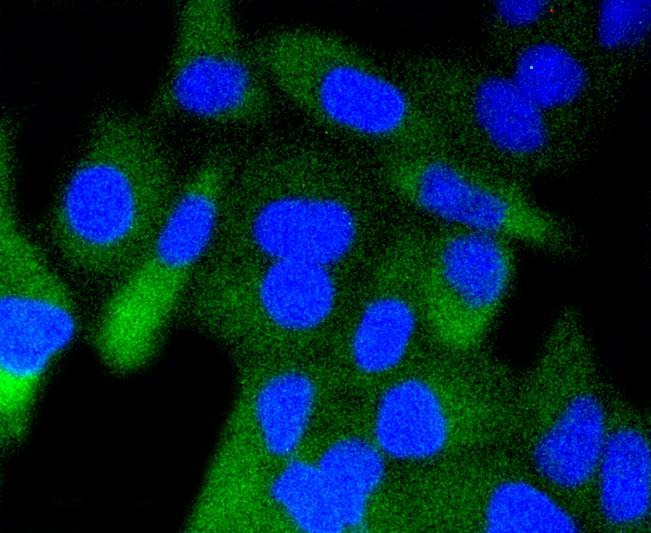 Anti-Phospho-GSK3B (Ser 9) Antibody (9V640)