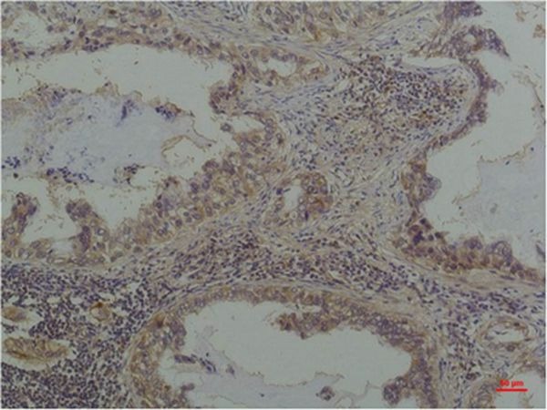 Anti-Phosphoserine Antibody (5A614)