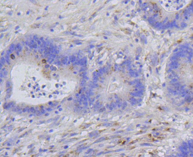 Anti-Phospho-Histone H1.3/1.4 (Thr17) Antibody (6O691)
