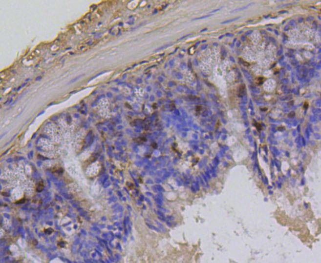Anti-Phospho-Histone H1.3/1.4 (Thr17) Antibody (6O691)