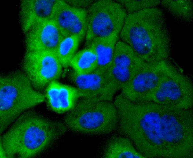 Anti-Phospho-RPS6KA1 (Ser380) Antibody (2P405)