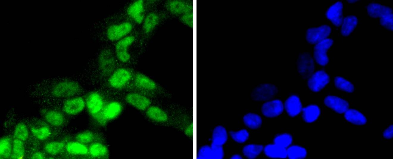 Anti-Phospho-RPS6KA1 (Thr359, Ser363) Antibody (9N204)