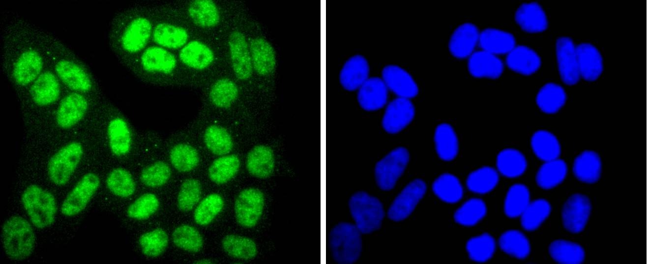 Anti-Phospho-SIRT1 (Thr530) Antibody (4S678)