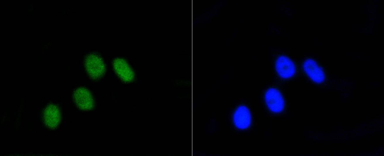Anti-Phospho-RB1 (Ser807) Antibody (7O884)