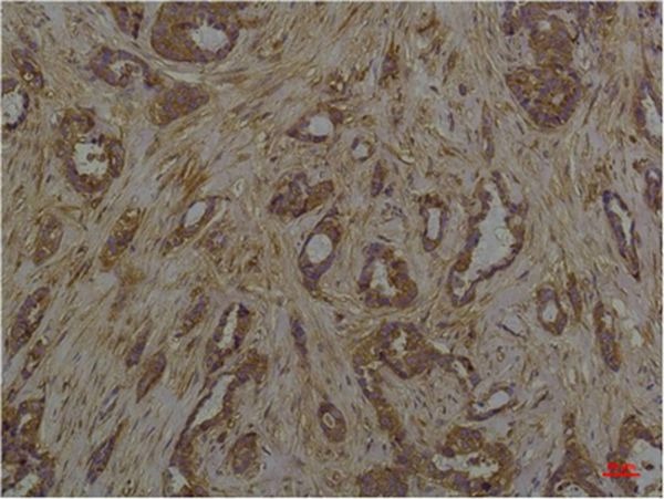 Anti-Phosphoserine Antibody (5A614)