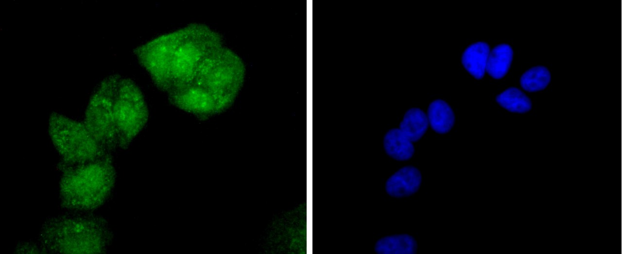 Anti-Phospho-HSF1 (Ser326) Antibody (1V417)