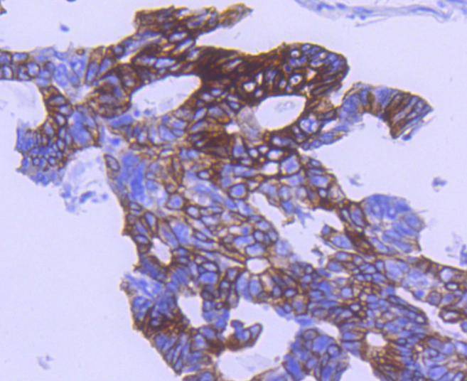 Anti-Phospho-GSK3B (Ser 9) Antibody (9V640)
