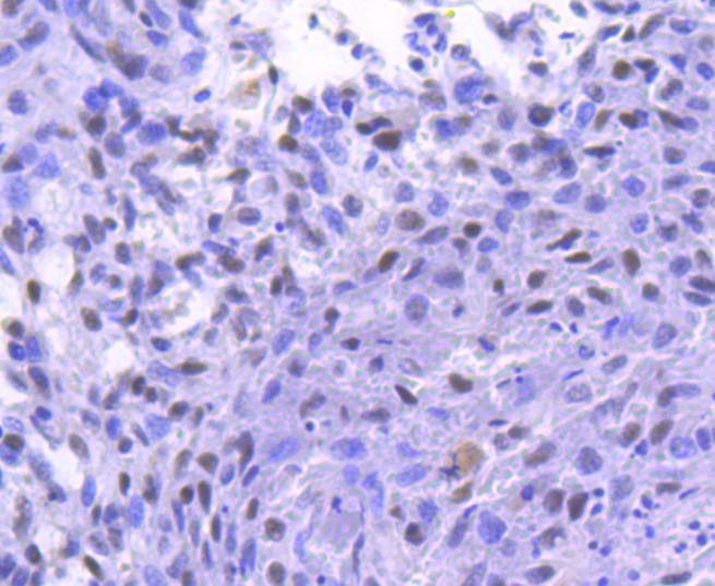 Anti-Phospho-RPS6KA1 (Thr359, Ser363) Antibody (9N204)