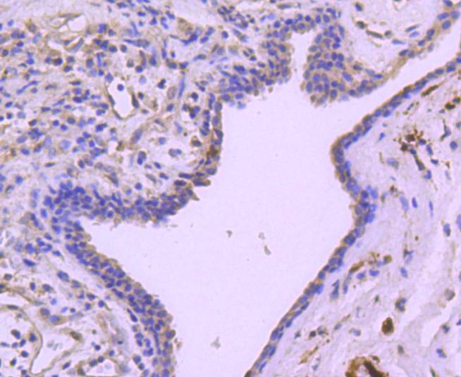 Anti-Phospho-Hsp27/HSPB (Ser78) Antibody (3C571)