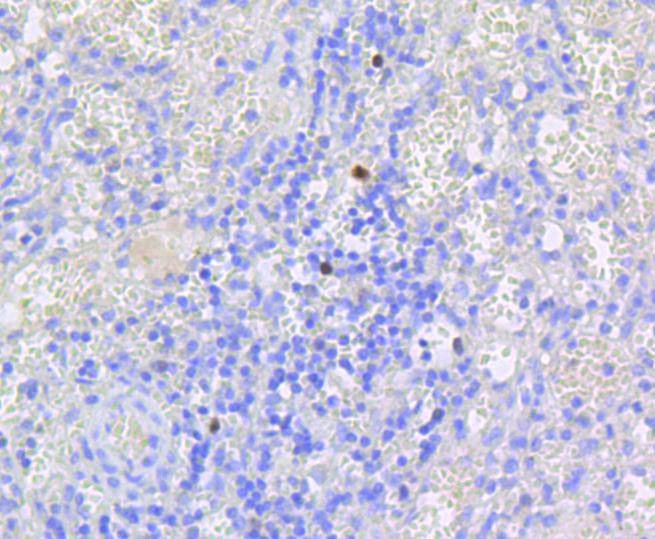 Anti-Phospho-RB1 (Ser807) Antibody (7O884)