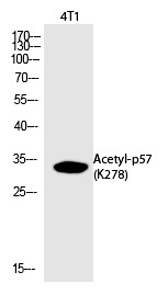 Anti-Acetyl-p57 (Lys278) Polyclonal Antibody