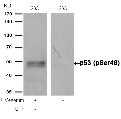 Anti-Phospho-p53 (Ser46) Polyclonal Antibody