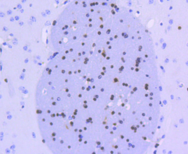 Anti-Olig-2/Oligo2 Antibody (2L225)