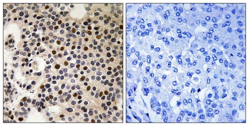 Anti-Phospho-PAK2 (Ser197) Polyclonal Antibody 2