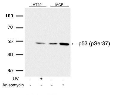 Anti-Phospho-p53 (Ser37) Polyclonal Antibody