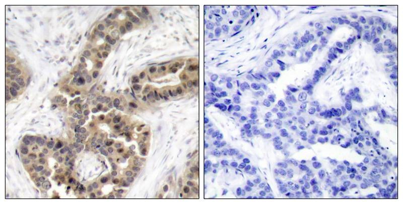 Anti-Phospho-CDKN1A (Thr145) Polyclonal Antibody