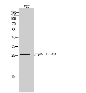 Anti-Phospho-CDKN1B (Thr198) Polyclonal Antibody