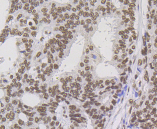 Anti-NONO Antibody (8D270)