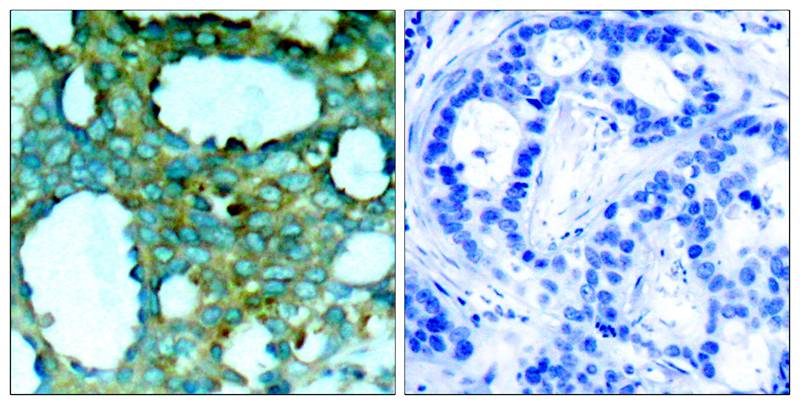 Anti-Phospho-PAK1 (Thr212) Polyclonal Antibody