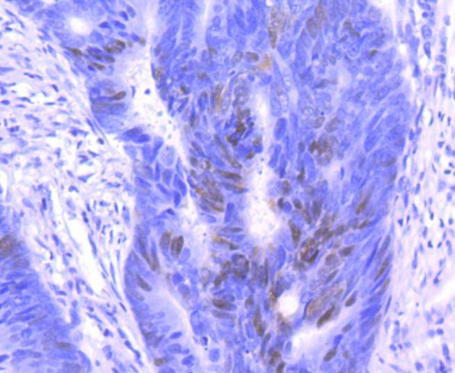 Anti-CDKN1B Antibody (9B660)