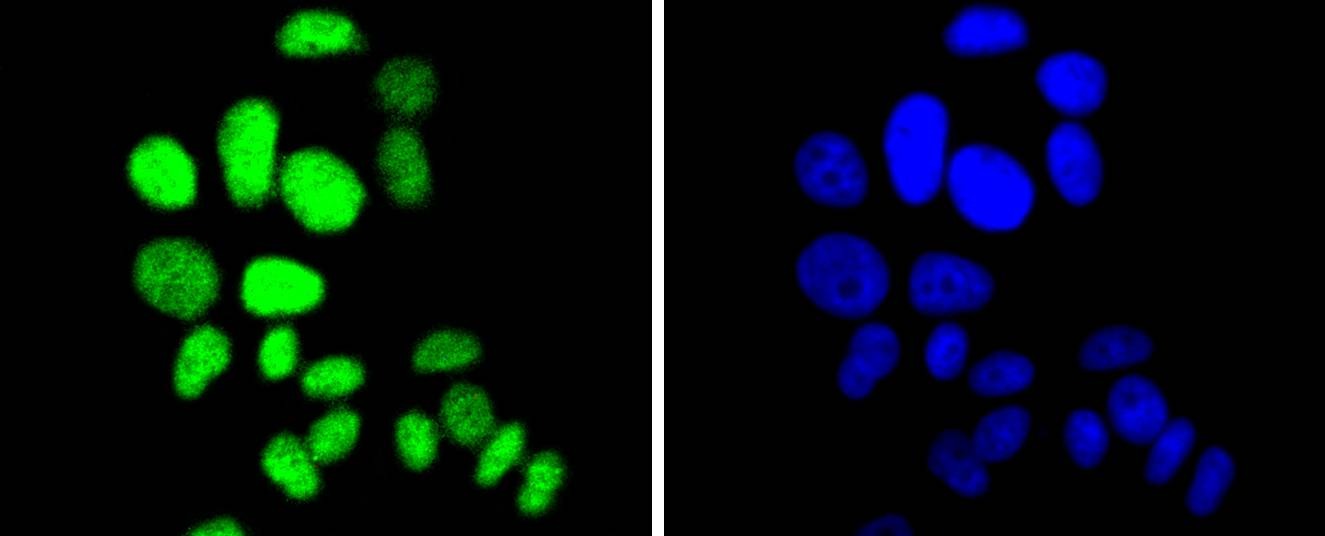Anti-CDKN1B Antibody (9B660)