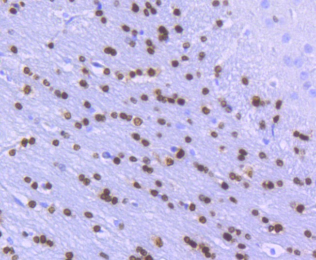 Anti-Olig-2/Oligo2 Antibody (2L225)