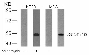 Anti-Phospho-p53 (Thr18) Polyclonal Antibody