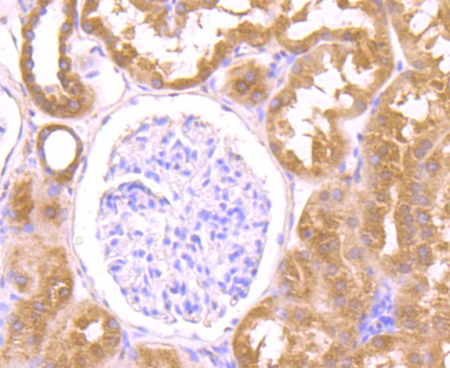 Anti-OGT Antibody (8O260)