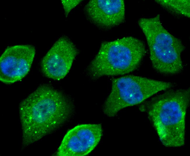 Anti-OGT Antibody (8O260)