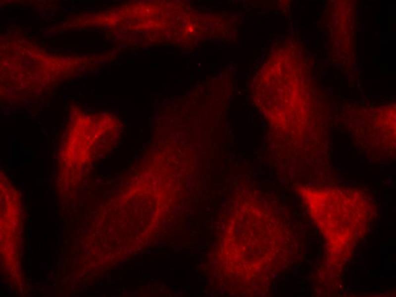 Anti-Phospho-p53 (Ser33) Polyclonal Antibody