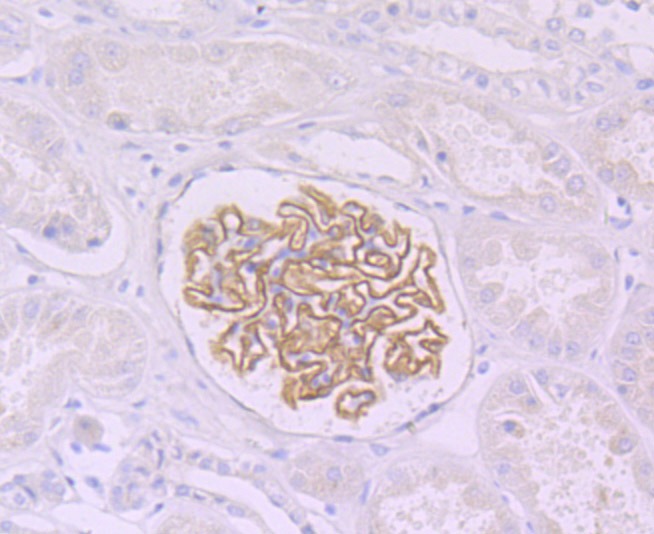 Anti-Podocin Antibody (6Q959)