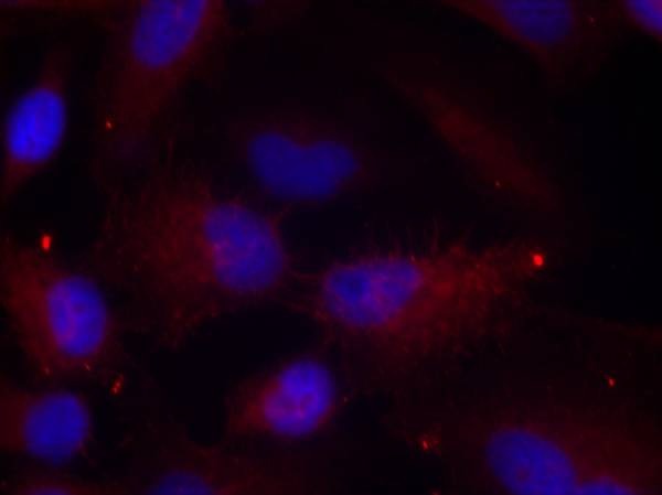Anti-Phospho-PAK1/2/3 (Thr423/402/421) Polyclonal Antibody