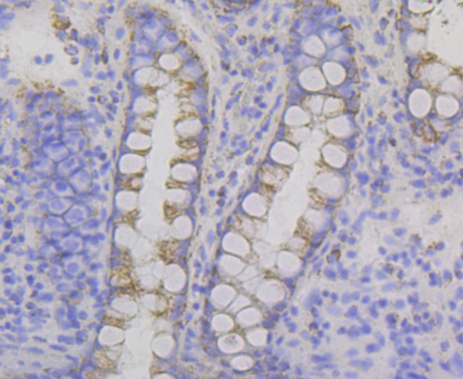 Anti-P2Y6 Antibody (7J344)