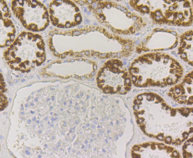 Anti-P2Y6 Antibody (7J344)