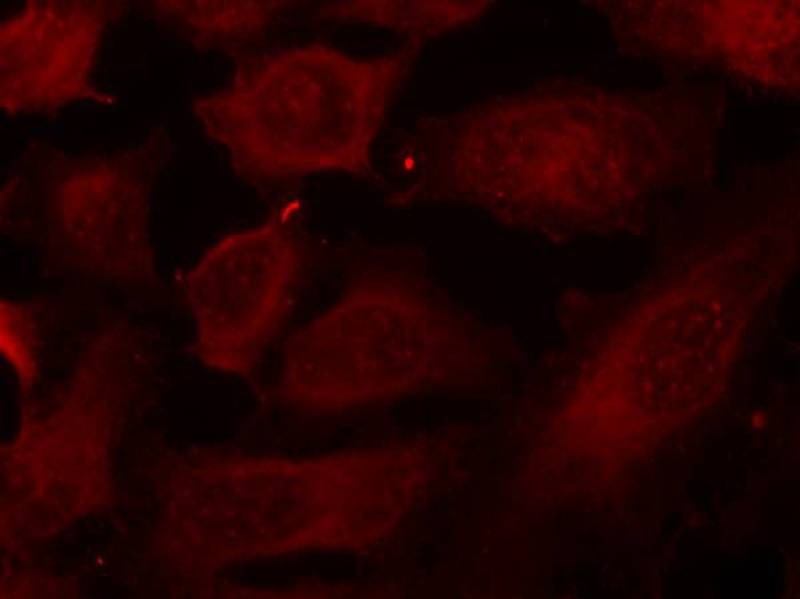 Anti-Phospho-p56 Dok-2 (Tyr299) Polyclonal Antibody