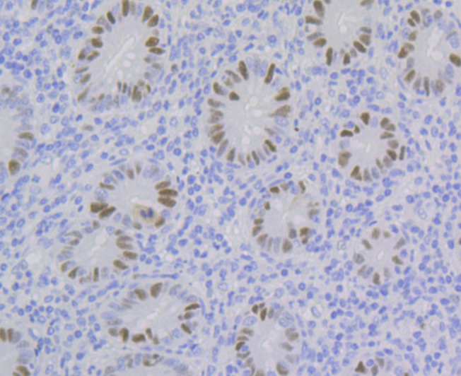 Anti-p60 CAF1 Antibody (4X99)
