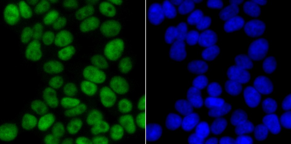 Anti-p60 CAF1 Antibody (4X99)
