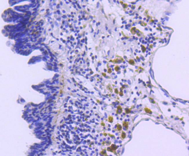 Anti-CDKN1B Antibody (9B660)