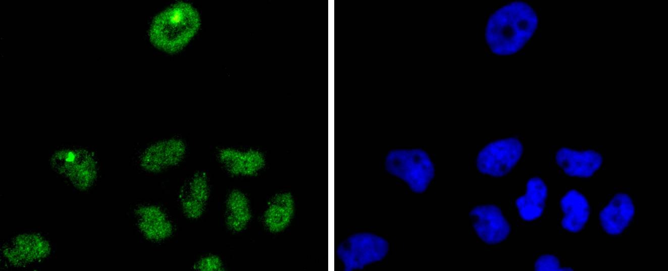 Anti-CDKN1B Antibody (9B660)