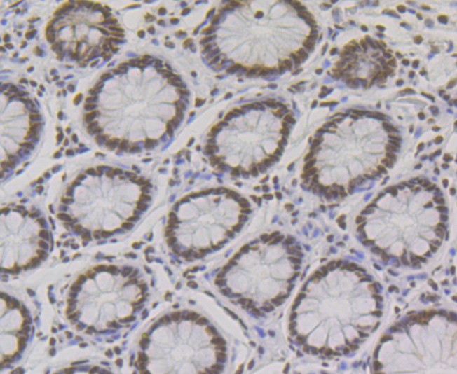 Anti-NONO Antibody (8D270)