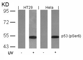 Anti-Phospho-p53 (Ser6) Polyclonal Antibody