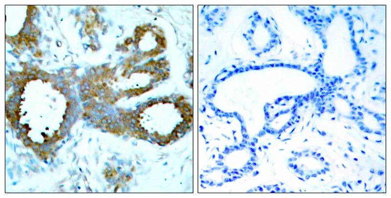 Anti-Phospho-PAK1/2/3 (Thr423/402/421) Polyclonal Antibody