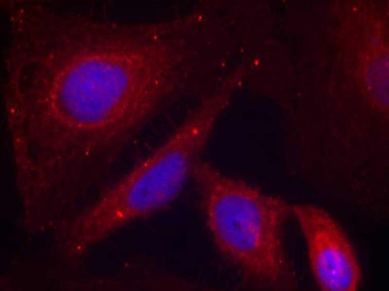 Anti-Phospho-PAK1 (Thr212) Polyclonal Antibody