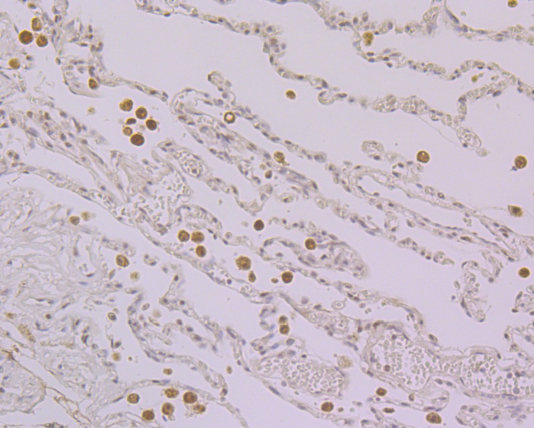 Anti-Nucleostemin Antibody (4J11)