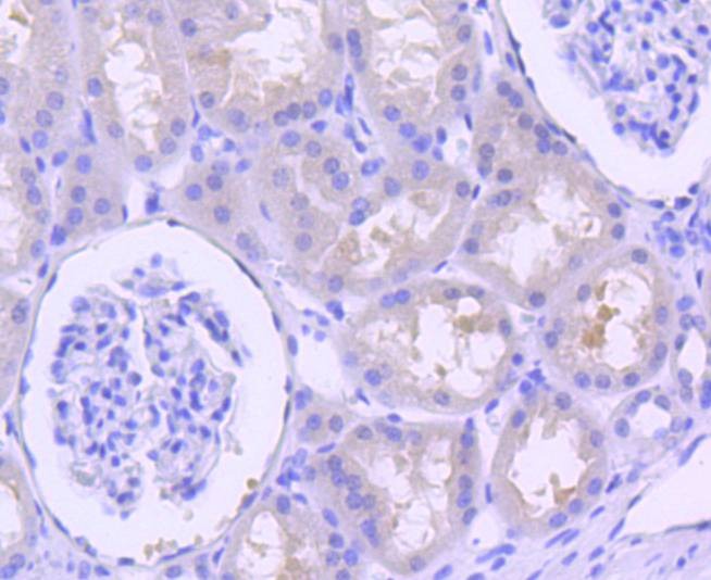 Anti-p16-INK4a Antibody (7Y998)
