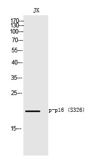 Anti-Phospho-p16 (Ser152) Polyclonal Antibody